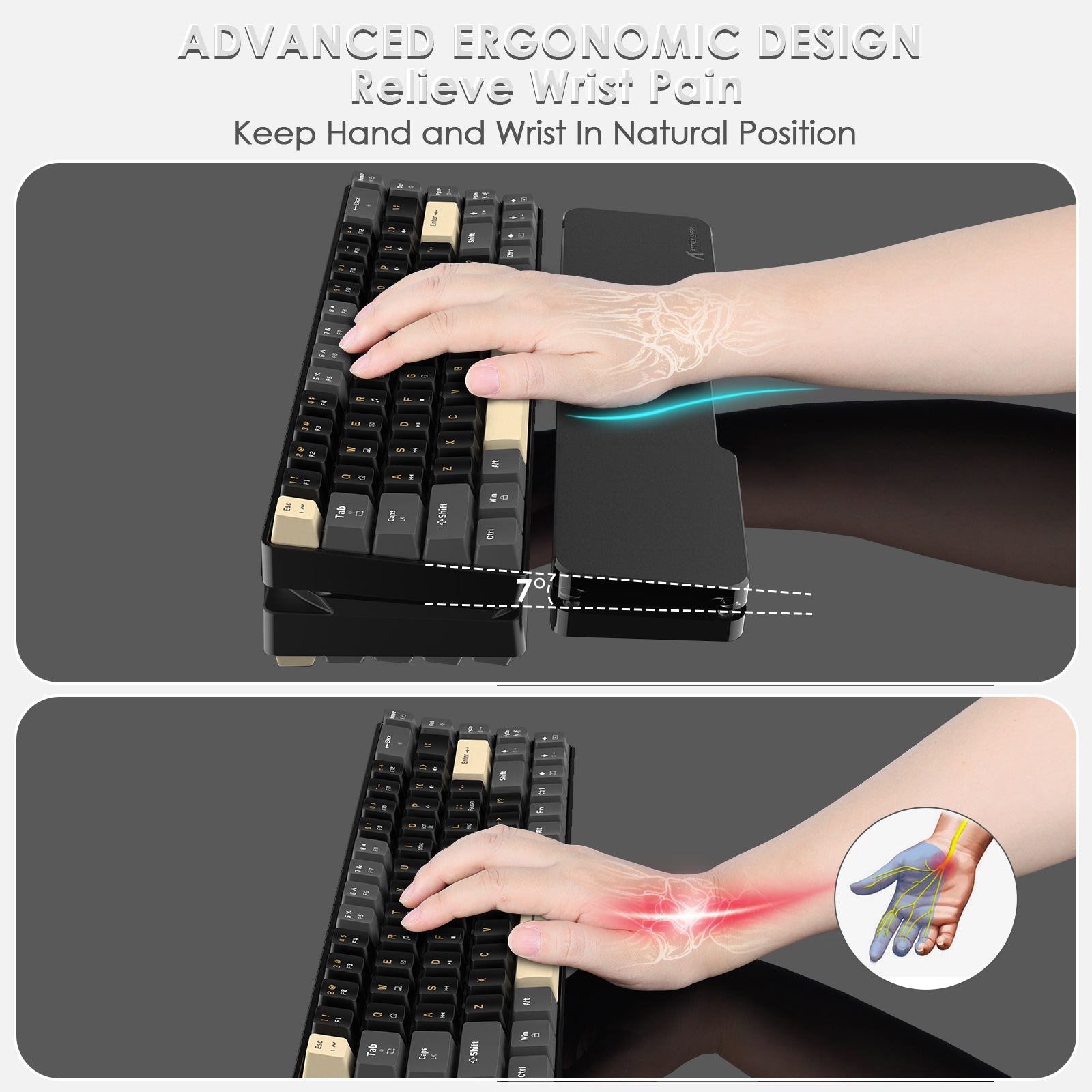 ATTACK SHARK ergonomic wrist rest supporting a black and gold keyboard, relieving wrist pain, ergonomic design
